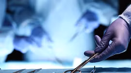 Hơn 1000 người Mỹ nghi bị nhiễm HIV do lỗi khử trùng