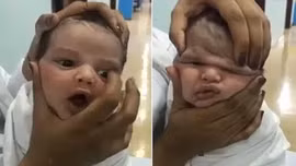 Video y tá 'vò mặt' bé sơ sinh gây phẫn nộ