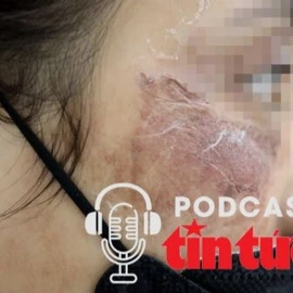 Cảnh báo tai biến sử dụng mỹ phẩm làm đẹp cấp tốc 