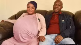 Ca sinh 10 hiếm có lập kỷ lục thế giới