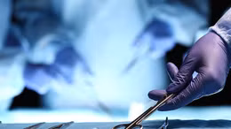 Hơn 1000 người Mỹ nghi bị nhiễm HIV do lỗi khử trùng