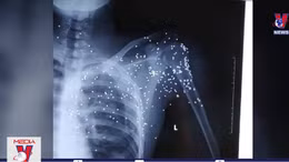 Khởi tố đối tượng nổ súng tại trạm BOT ở Thái Bình