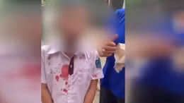 Phụ huynh vào trường hành hung cháu bé lớp 1