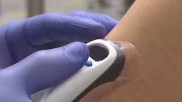 Công nghệ tia laser tiêm vaccine không đau đớn