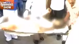 Bé trai Ấn Độ 12 tuổi bị ‘thiêu sống’ 