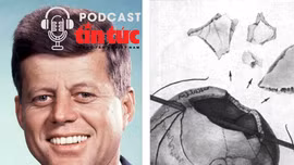 Hồ sơ mật: Bí ẩn bộ não biến mất của cựu Tổng thống Mỹ Kennedy
