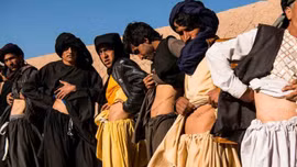 Nghèo đói cùng cực khiến nhiều người Afghanistan phải bán thận để sinh tồn