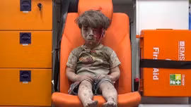 Nhói lòng hình ảnh cậu bé Syria trong xe cứu thương ở Aleppo