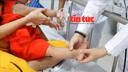 Cảnh giác chủng EV71 gây bệnh tay chân miệng biến chứng nặng