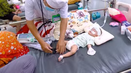 Không chủ quan với các bệnh ở mắt khi trẻ mắc cúm, sởi