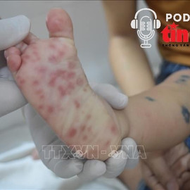 Bác sĩ ơi: Dấu hiệu nhận biết sớm bệnh tay chân miệng