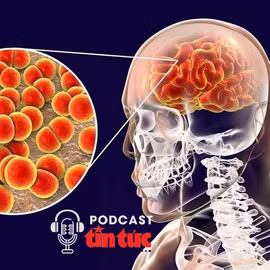 Bác sĩ ơi: Bệnh viêm não do mô cầu nguy hiểm thế nào với trẻ em?