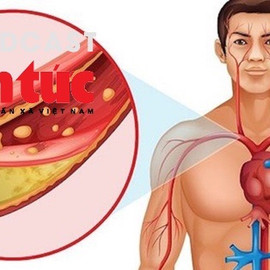 "Bác sĩ ơi' - Kiểm soát Cholesterol máu thế nào là đúng?