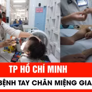 Dịch bệnh tay chân miệng tại TP Hồ Chí Minh gia tăng